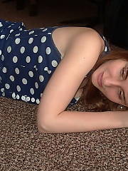 hairy redhaired