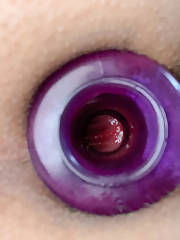 anal gape