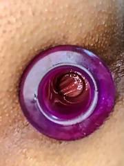 anal gape