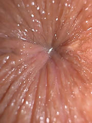 anus wet